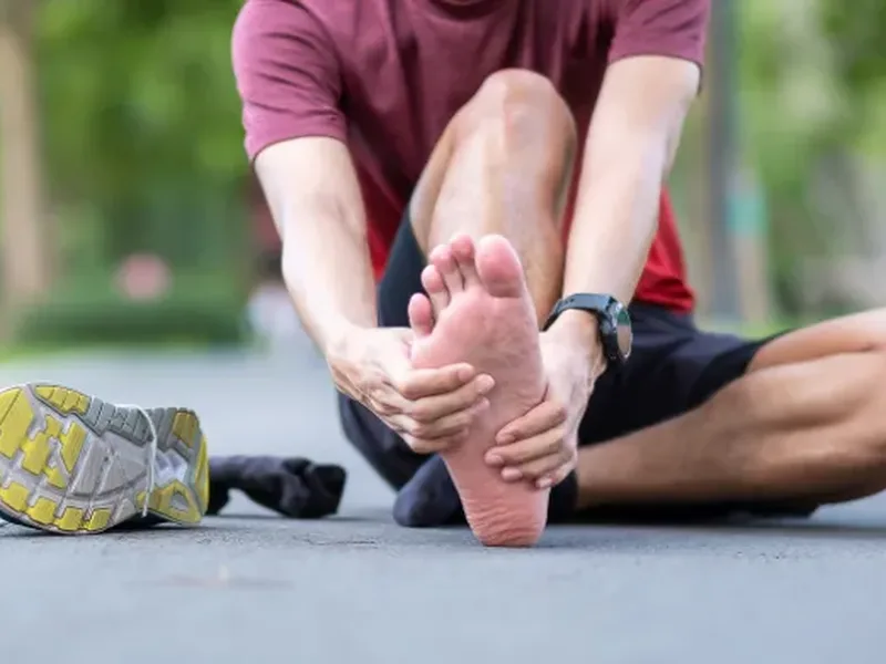 Physical therapist assessing a patient's foot and arch mechanics for plantar fasciitis