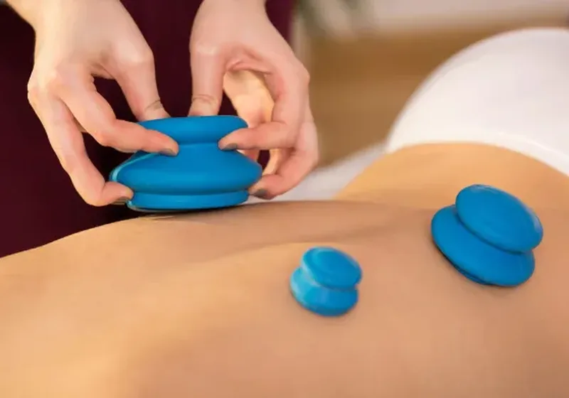 Cupping therapy session