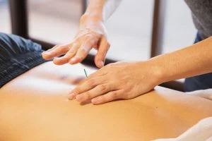Dry Needling: How it Helps Muscle Pain