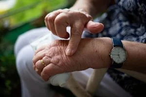 How to Manage Psoriatic Arthritis